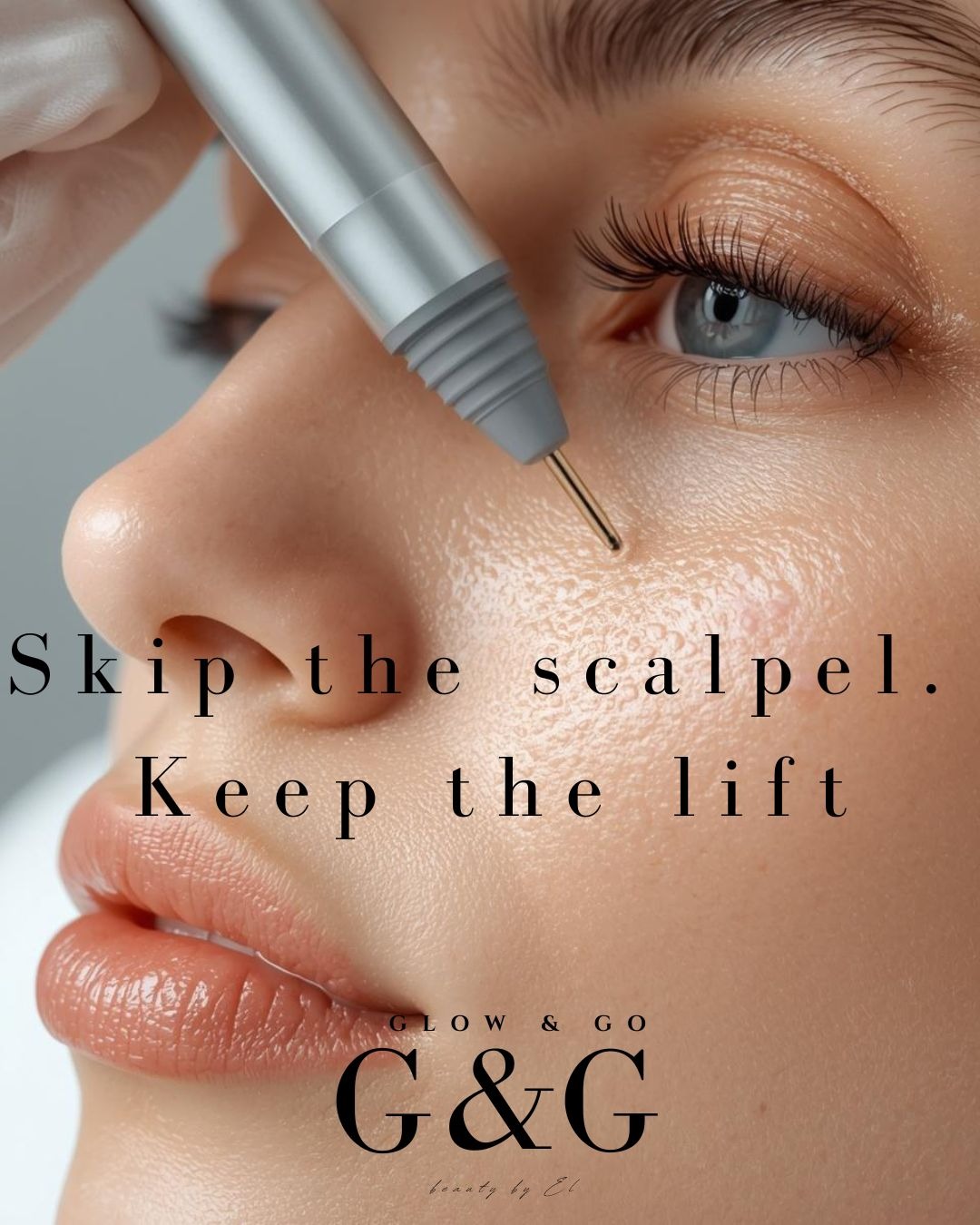 Plasma Skin Tightening - Skip the Scalpel